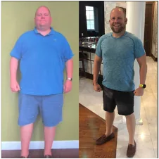 Chris Dorworth before and after