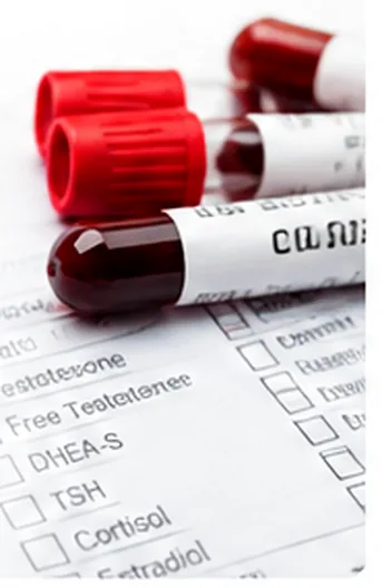 Blood collection tubes on a hormone lab requisition
