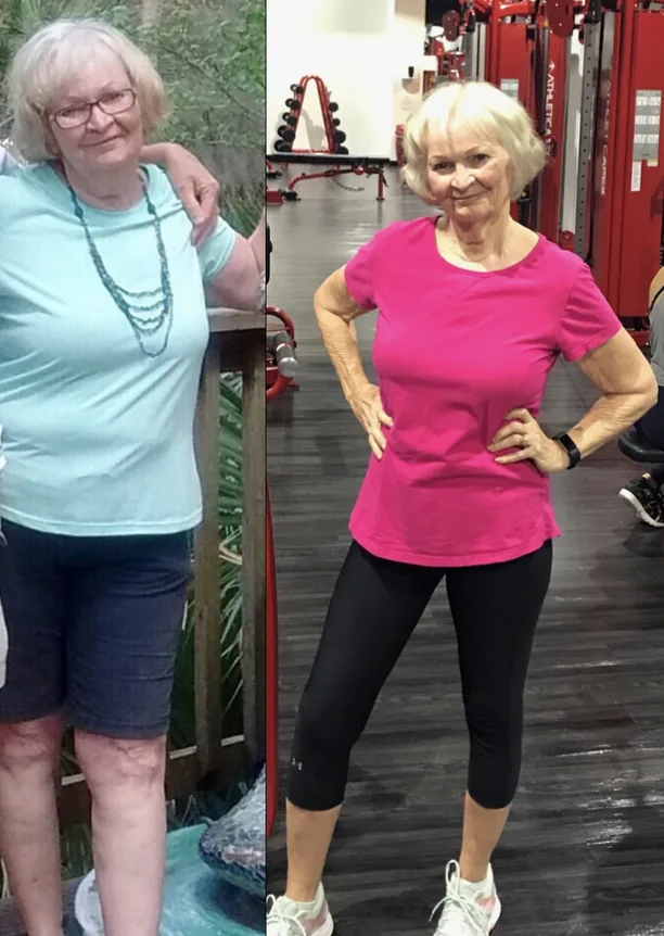 Marie V. before and after