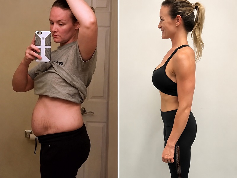 Britany Anderson before and after