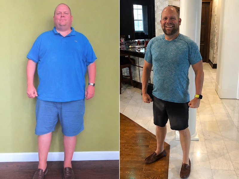 Chris Dorworth before and after