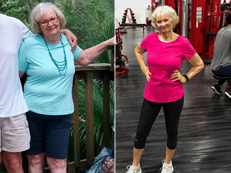 Marie Vincent before and after