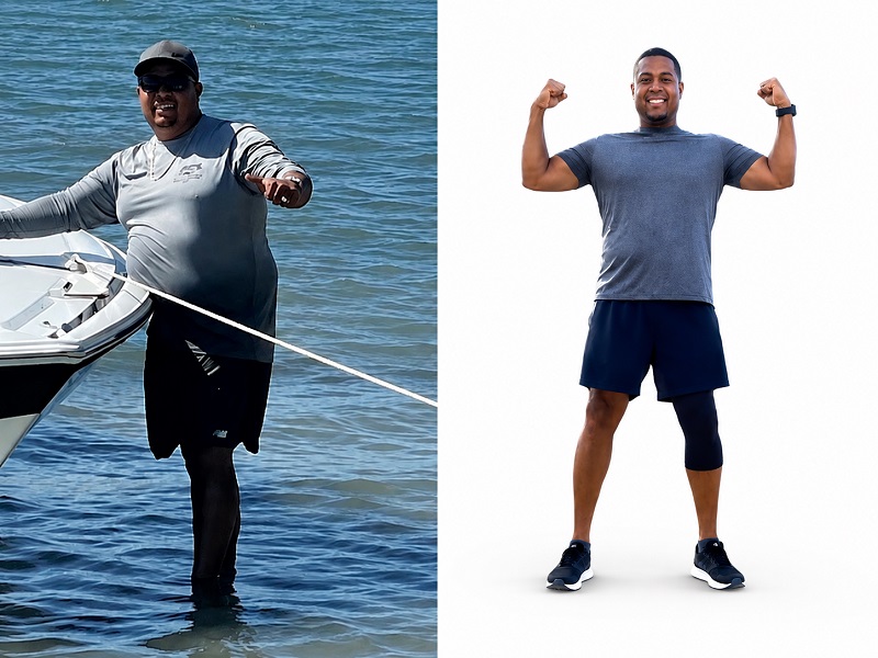 Chris Dorworth before and after