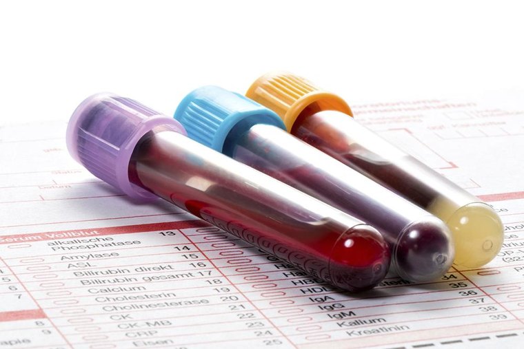 Comprehensive blood work test tubes on a lab panel