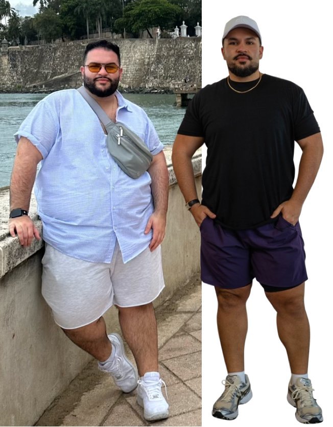 Carlos Velez before and after his Apex MD transformation