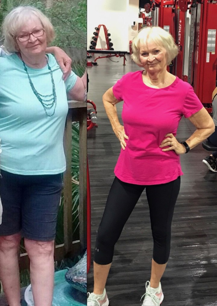Marie Vincent before and after her Apex MD transformation