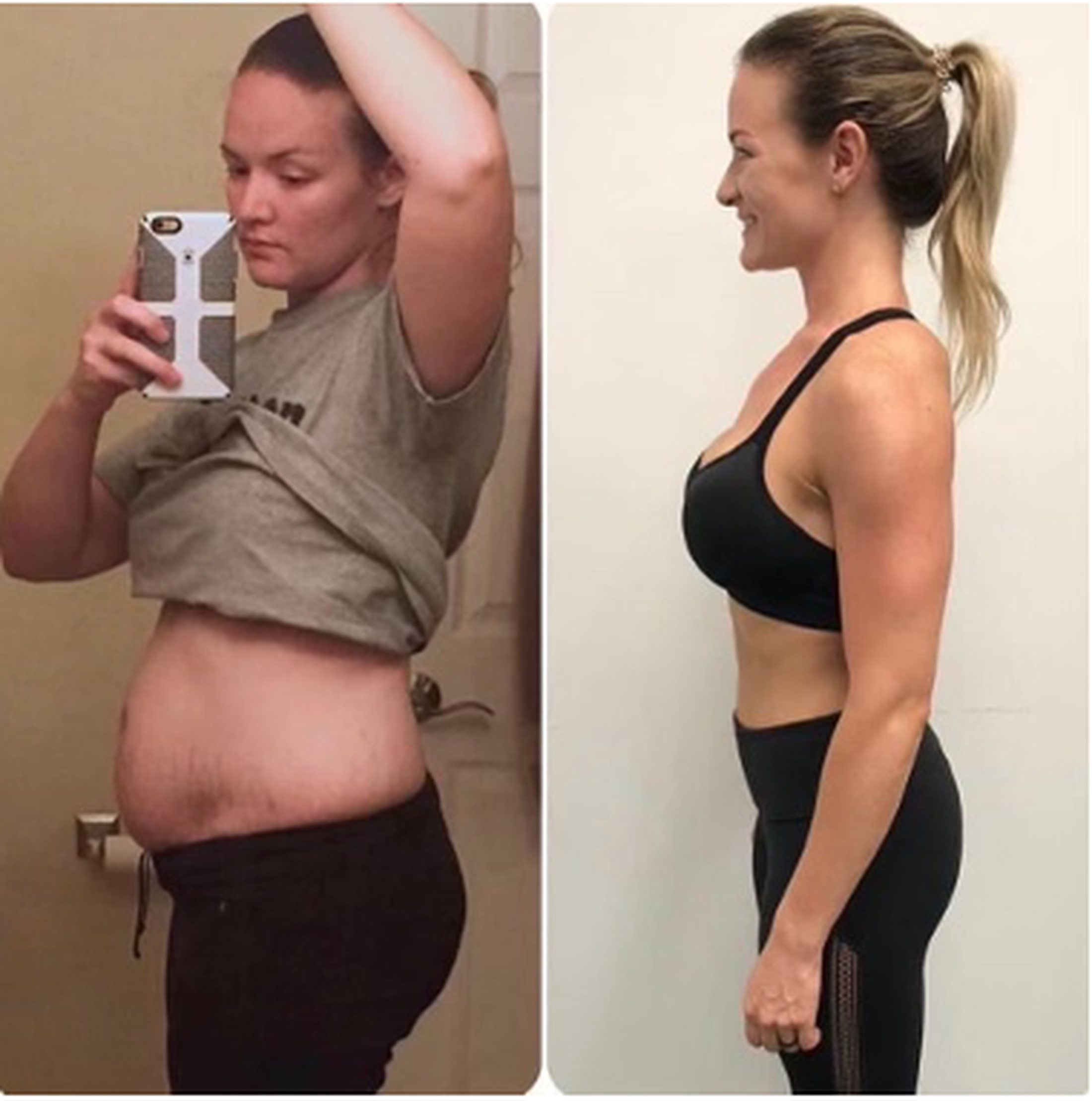Brittany A. before and after